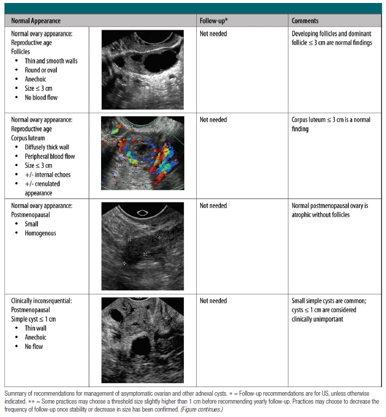 Ovarian Cyst F U Guideline Radiology World
