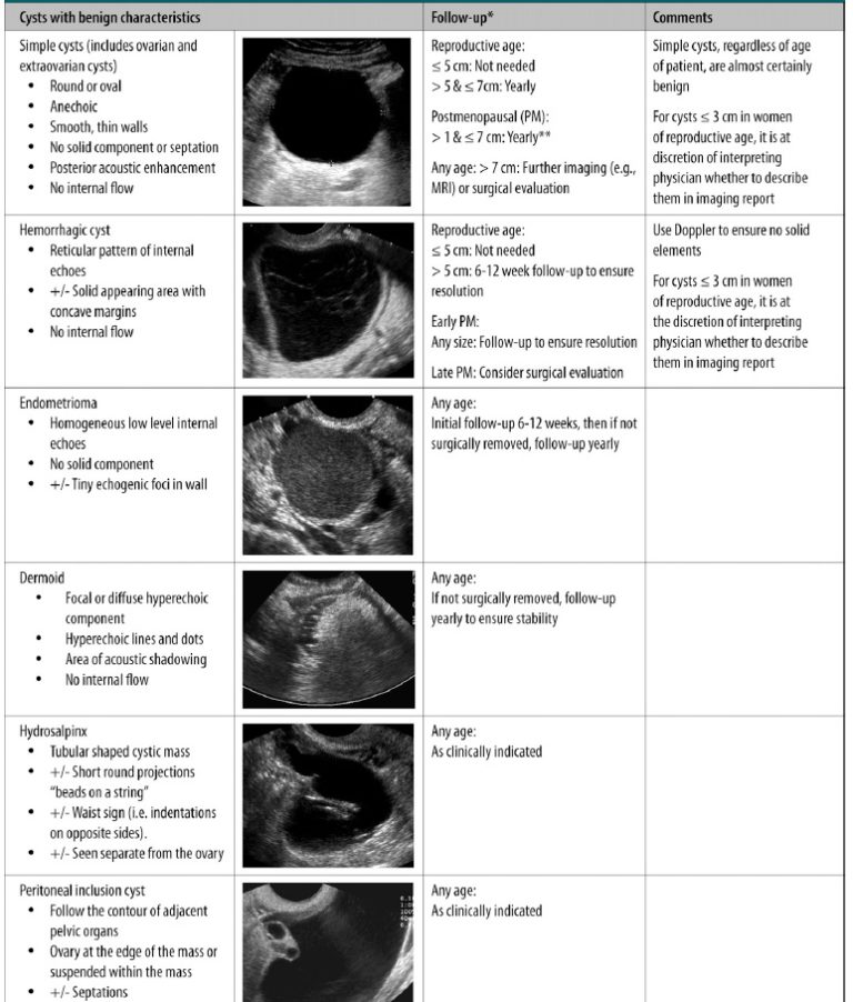 Ovarian Cyst F/U Guideline – Radiology.World